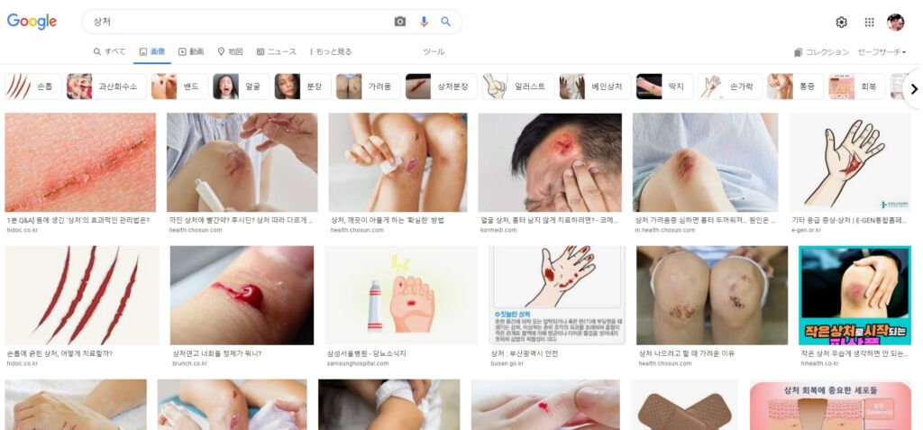 상처、흠집、기스(傷)の違いと使い分け